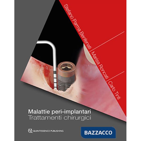 Malattie peri-implantari. Trattamenti chirurgici
