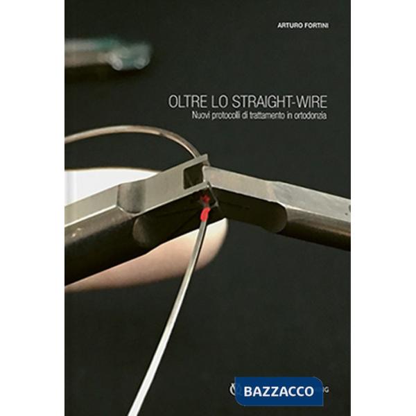 Oltre lo straight-wire. Nuovi protocolli di trattamento in ortodonzia. Con immagini e video