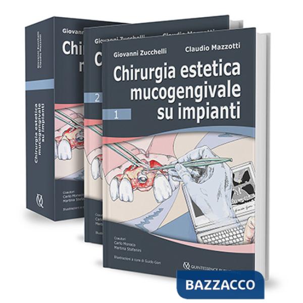 Chirurgia estetica mucogengivale su impianti