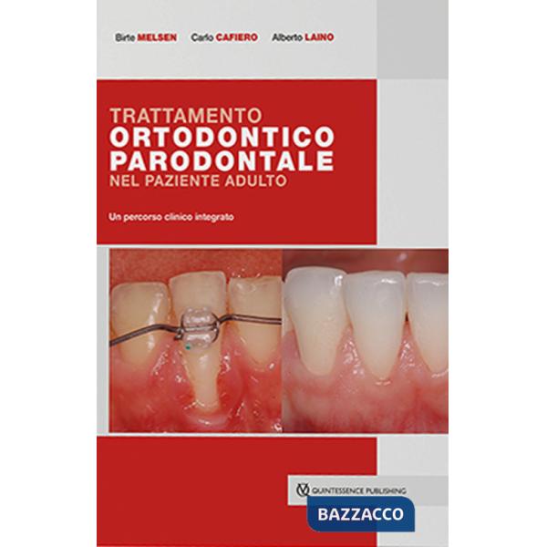 Trattamento ortodontico parodontale nel paziente adulto. Un percorso clinico integrato
