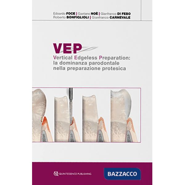 VEP. Vertical edgeless preparation: la dominanza parodontale nella preparazione protesica