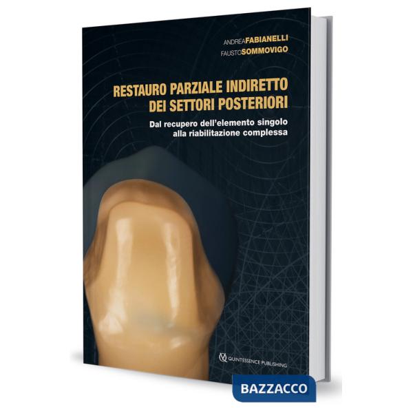 Restauro parziale indiretto dei settori posteriori. Dal recupero dell'elemento singolo alla riabilitazione complessa