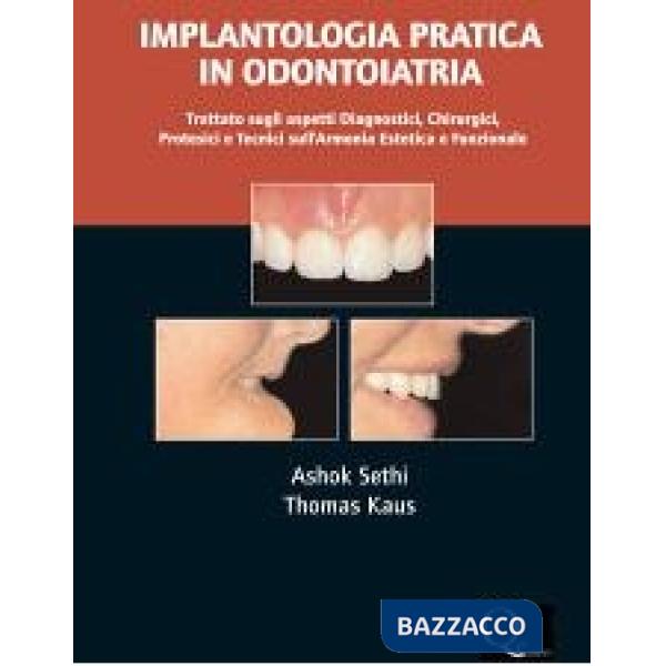 Implantologia pratica in odontoiatria. Trattato sugli aspetti diagnostici, chirurgici, protesici e tecnici dell'armonia estetica