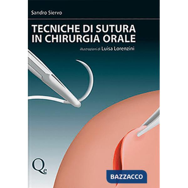 Tecniche di sutura in chirurgia orale