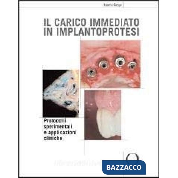 Carico immediato in implantoprotesi (Il)