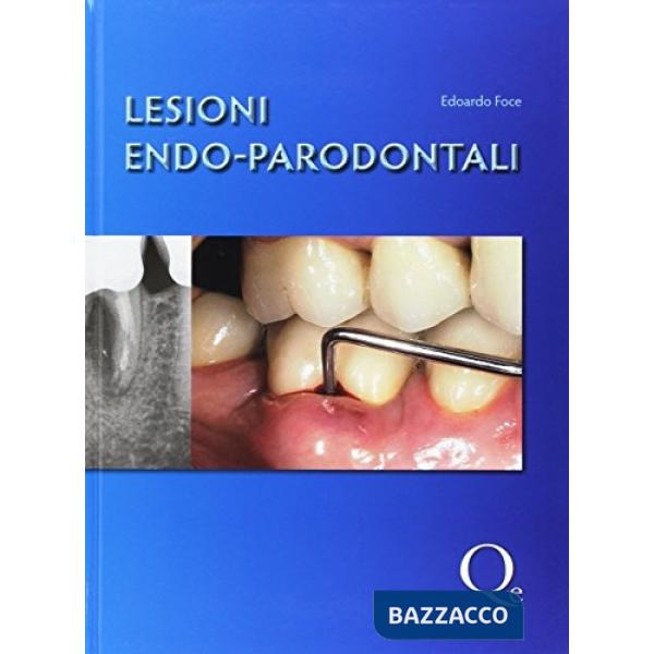 Lesioni endo-parodontali
