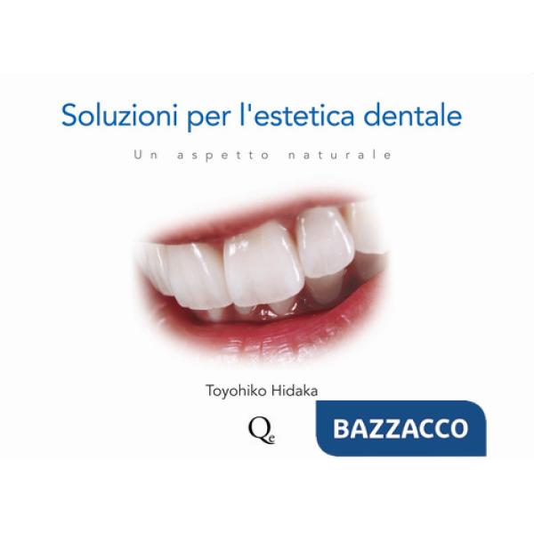 Soluzioni per l'estetica dentale. Un aspetto naturale