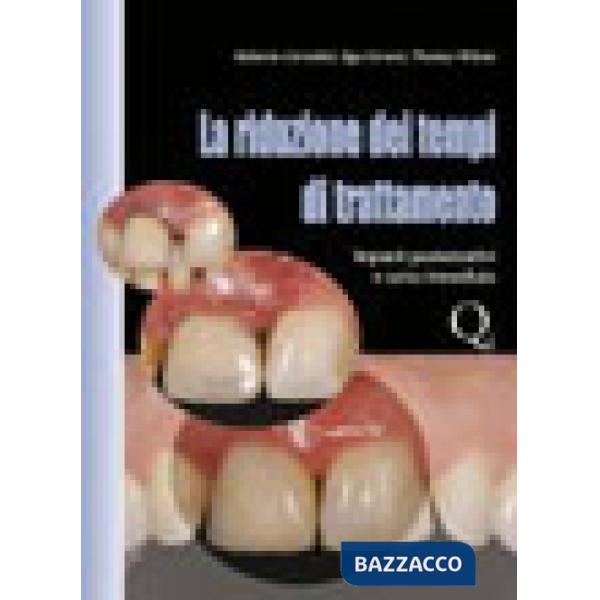 Riduzione dei tempi di trattamento. Impianti postestrattivi e carico immediato (La)