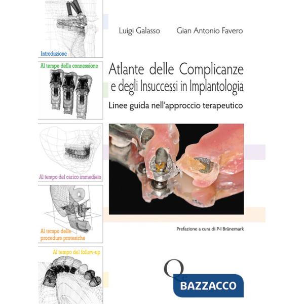 Atlante delle complicanze e degli insuccessi in implantologia. Linee guida nell'approccio terapeutico