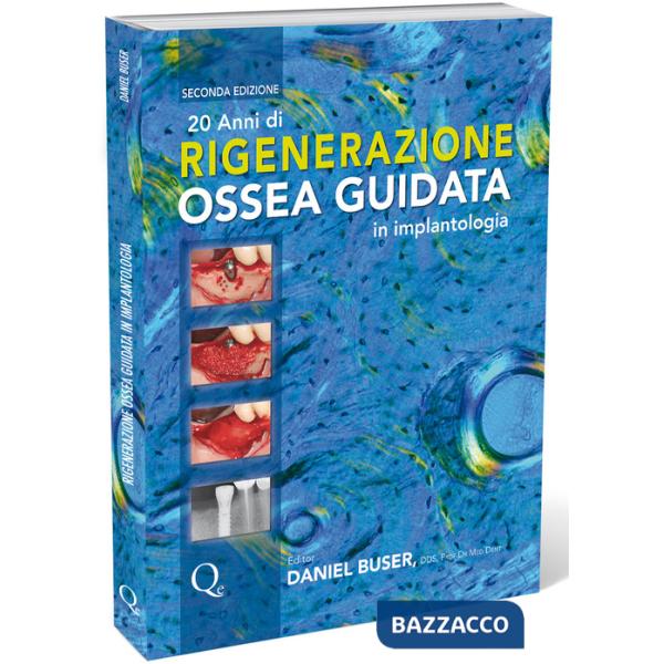 20 anni di rigenerazione ossea guidata in implantologia