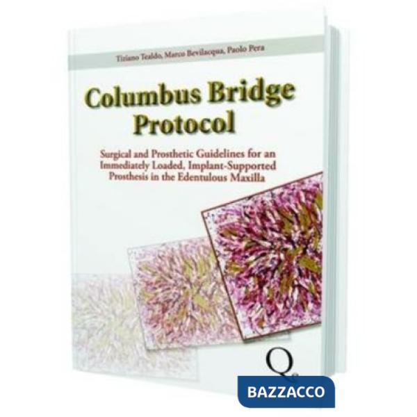 Columbus bridge protocol. Surgical and prosthetic guidelines for an immediately loaded, implant-supported prosthesis in the eden