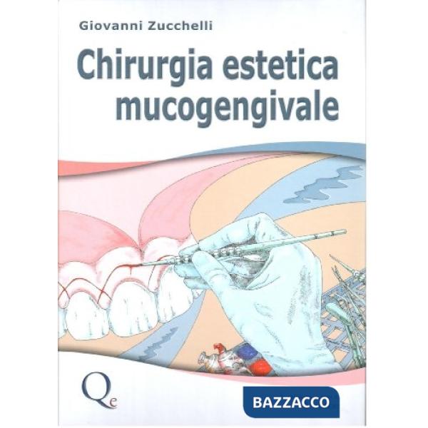 Chirurgia estetica mucogengivale