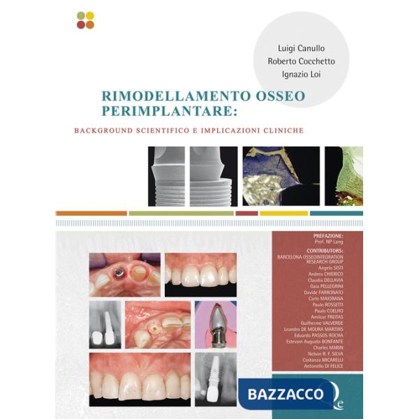 Rimodellamento osseo perimplantare. Background scientifico e implicazioni cliniche