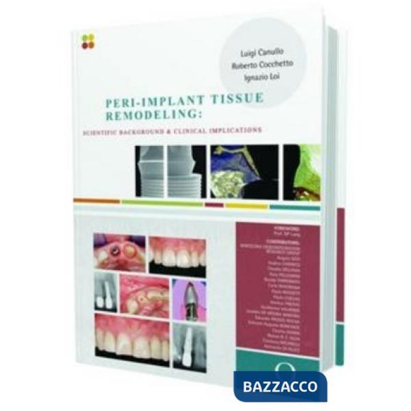 Peri-implant tissue remodeling. Scientific background and clinical implications