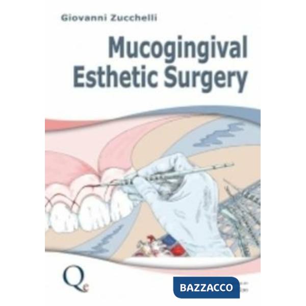 Mucogingival esthetic surgery. Nuova ediz.
