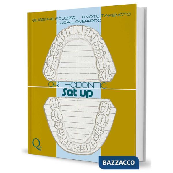Orthodontic Set Up. Ediz. italiana