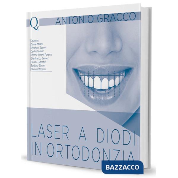 Laser a diodi in ortodonzia