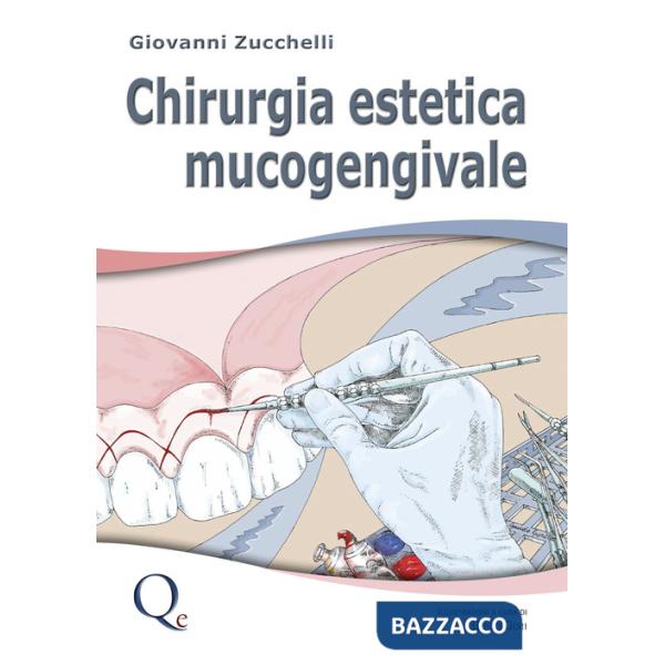 Chirurgia estetica mucogengivale