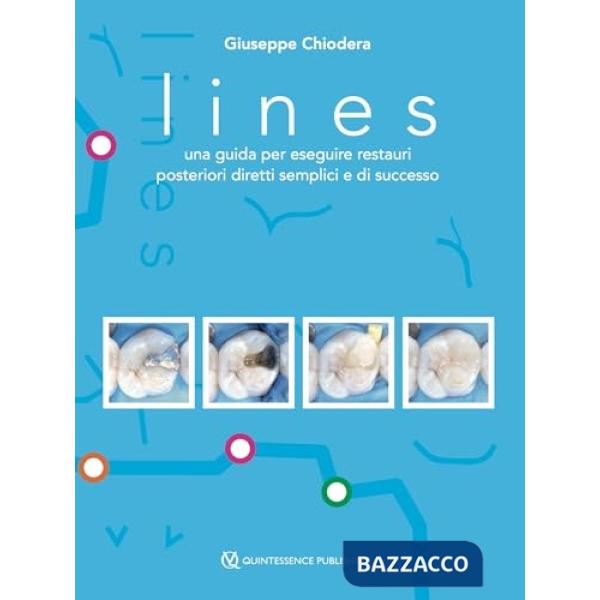 Lines. Una guida per eseguire restauri posteriori diretti semplici e di successo