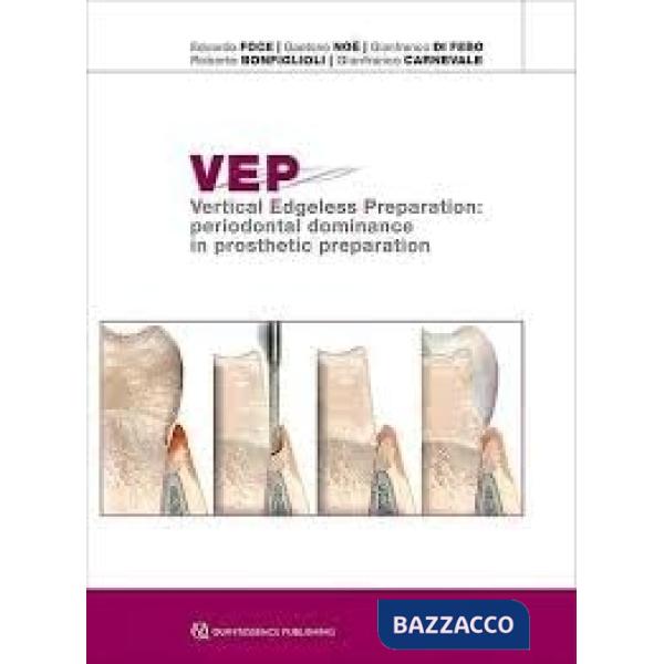 VEP. Vertical Edgeless Preparation: periodontal dominance in prosthetic preparation