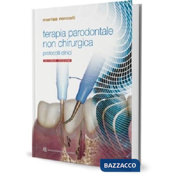 Terapia parodontale non chirurgica. Indicazioni, limiti e protocolli clinici con l'uso aggiuntivo del laser a diodo