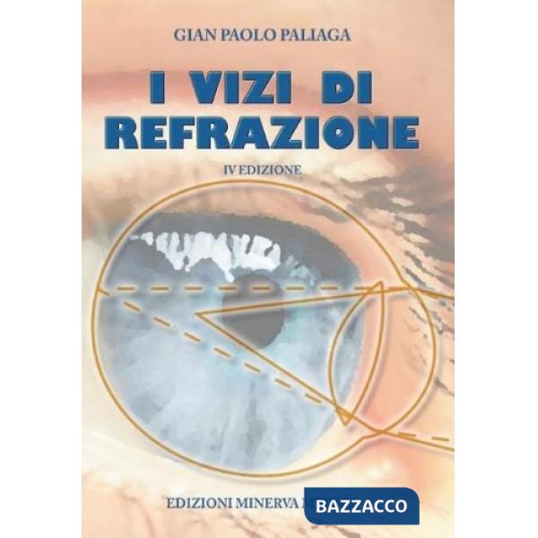VIZI DI REFRAZIONE (I)
