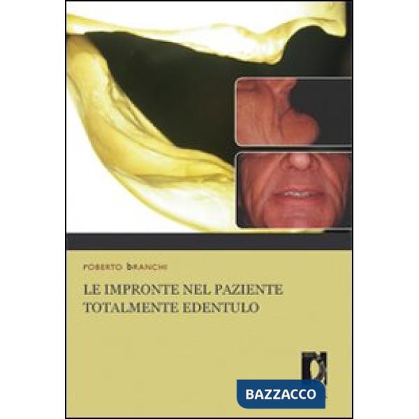 Impronte nel paziente totalmente edentulo (Le)
