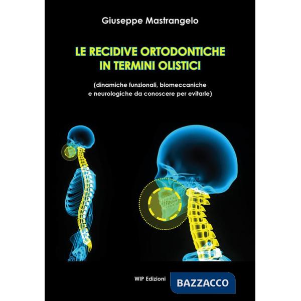 Recidive ortodontiche in termini olistici. Dinamiche funzionali, biomeccaniche e neurologiche da conoscere per evitarle (Le)