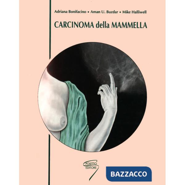 Carcinoma della mammella