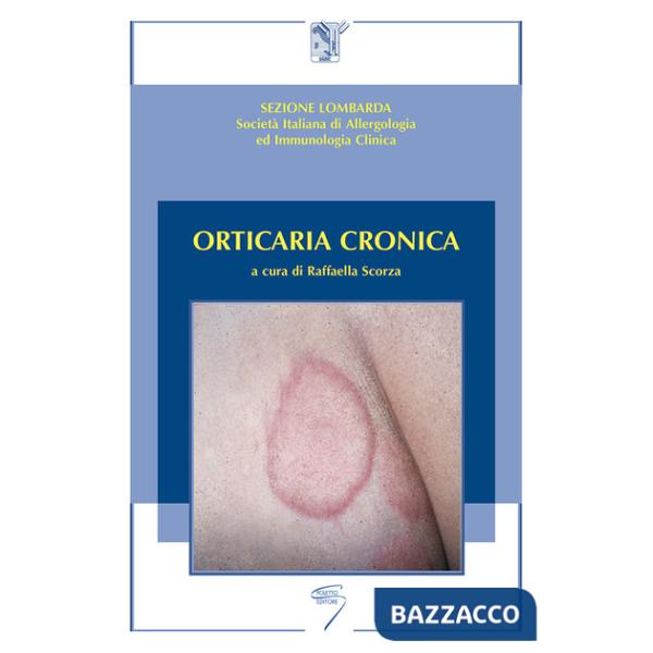 Orticaria cronica