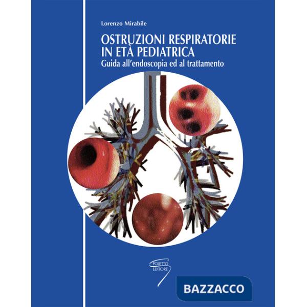 Ostruzioni respiratorie in pediatria. Guida all'endoscopia ed al trattamento