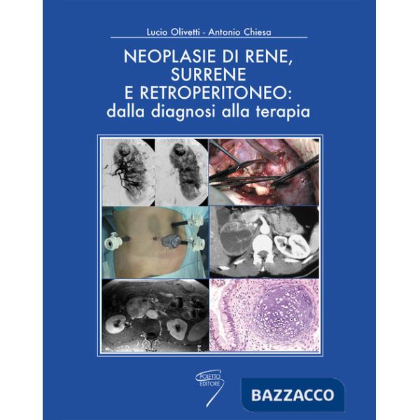 Neoplasie di rene, surrene e retroperitioneo: dalla diagnosi alla terapia