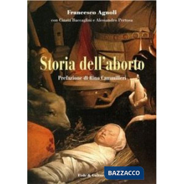 Storia dell'aborto