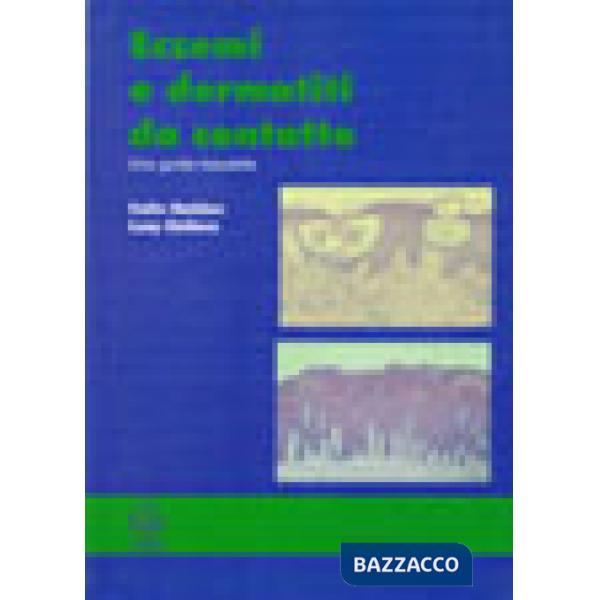 Eczemi e dermatiti da contatto