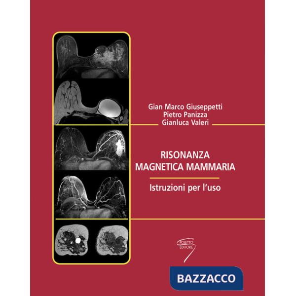 Risonanza magnetica mammaria. Istruzioni per l'uso