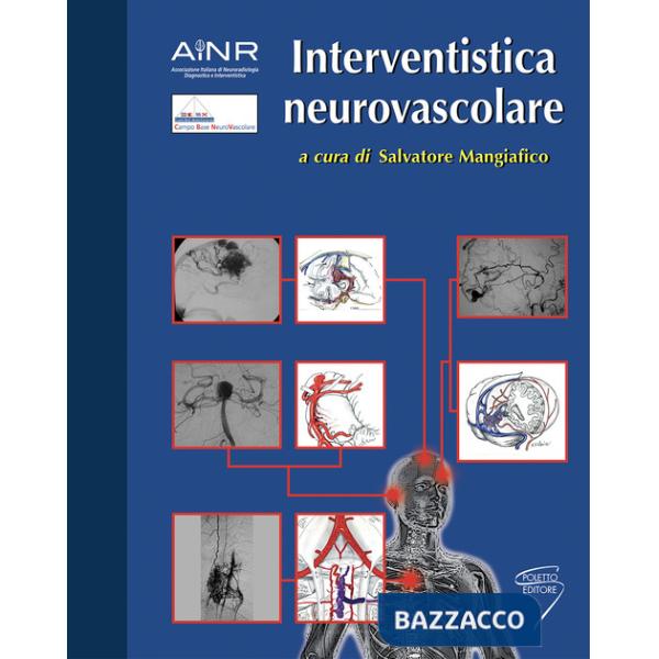 Interventistica neurovascolare