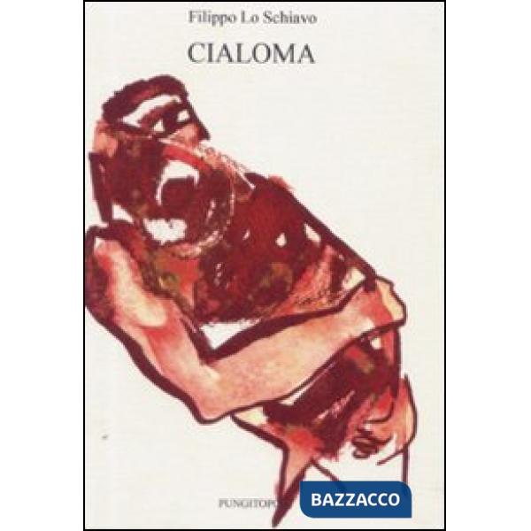 Cialoma