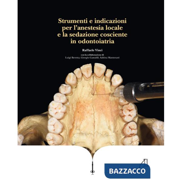 Strumenti e indicazioni per l'anestesia locale e la sedazione cosciente in odontoiatria