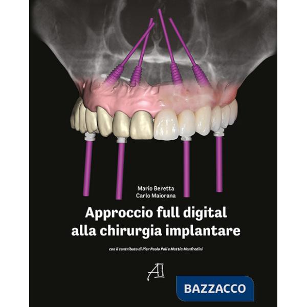 Approccio full digital alla chirurgia implantare