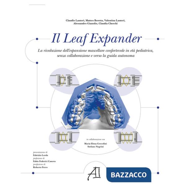 Leaf Expander. La rivoluzione dell'espansione mascellare confortevole in età pediatrica senza collaborazione e verso la guida au