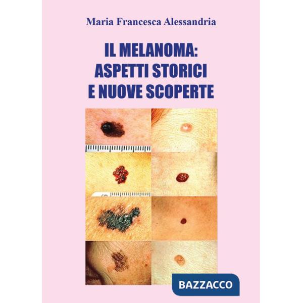 Melanoma: aspetti storici e nuove scoperte (Il)