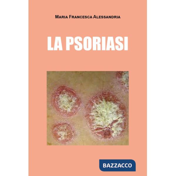 Psoriasi (La)