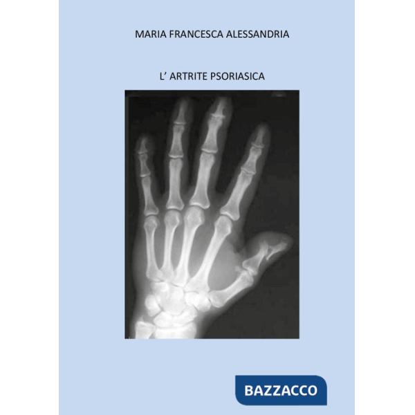 Artrite psoriasica (L')