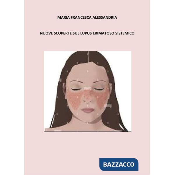 Nuove scoperte sul lupus erimatoso sistemico