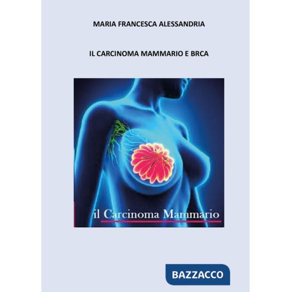 Carcinoma mammario e BRCA (Il)
