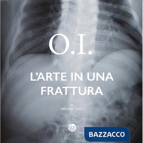 O.I. L'arte in una frattura