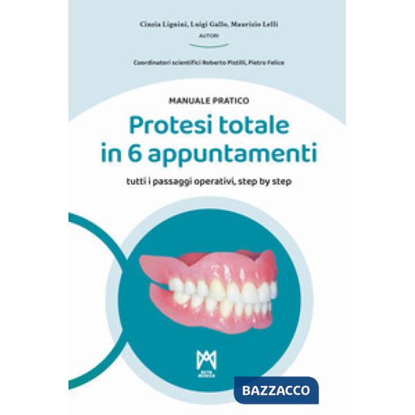 Protesi totale in 6 appuntamenti. Manuale pratico