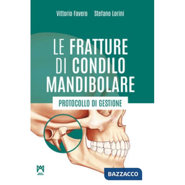 Le fratture di condilo mandibolare. Protocollo di gestione